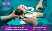 Having a C-section is related to difficulties with conceiving