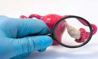 Androgen Excess? New Guidelines Shift Focus Beyond Just PCOS